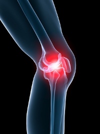 homeopathy rheumatism arthritis knee